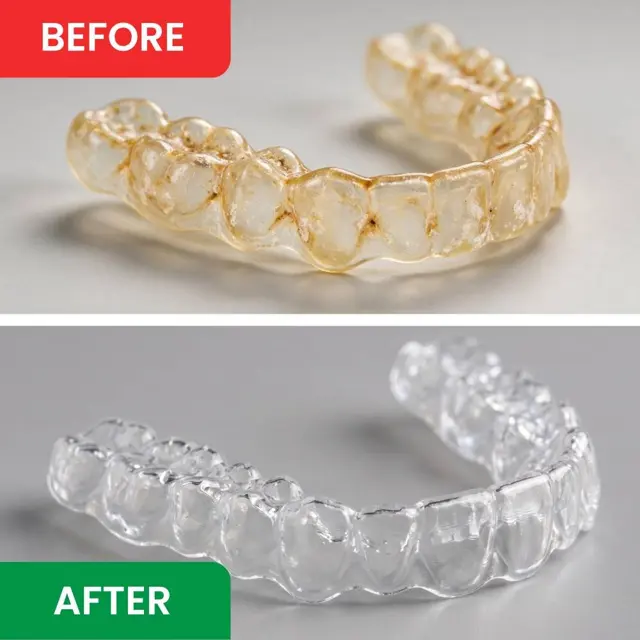 A yellowed retainer before cleaning and the same retainer clear after cleaning